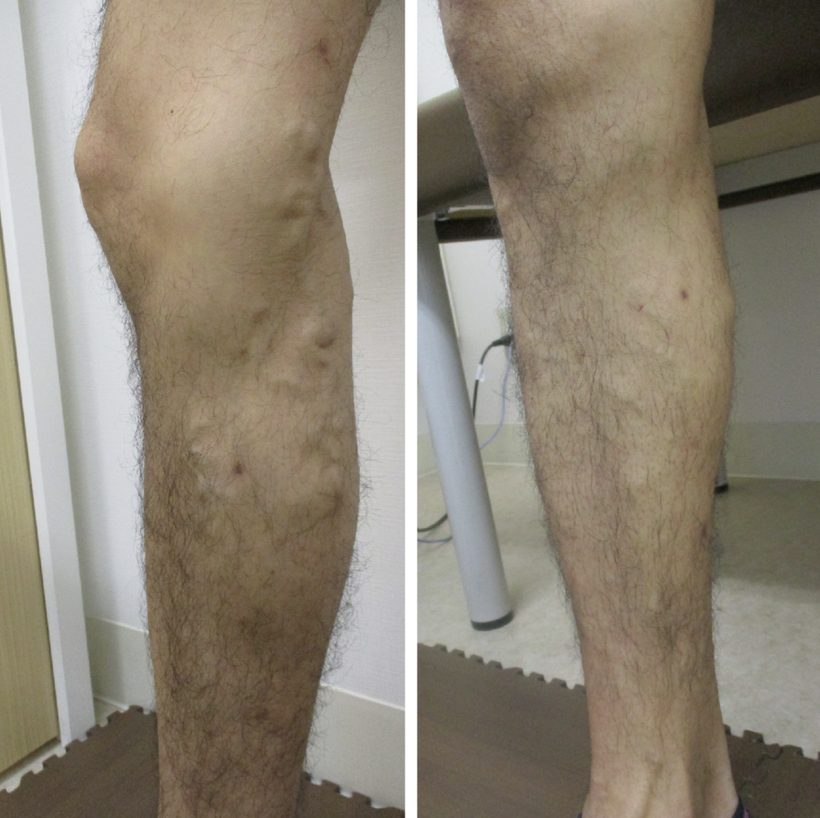 BEFORE